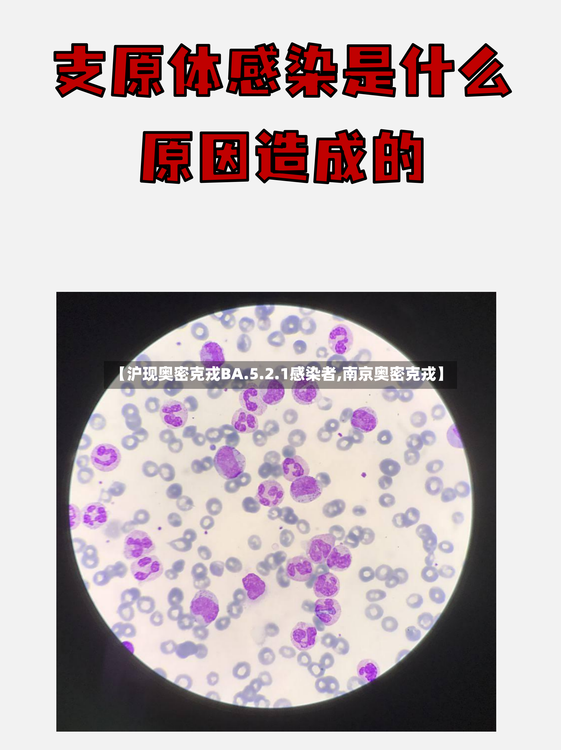 【沪现奥密克戎BA.5.2.1感染者,南京奥密克戎】-第3张图片