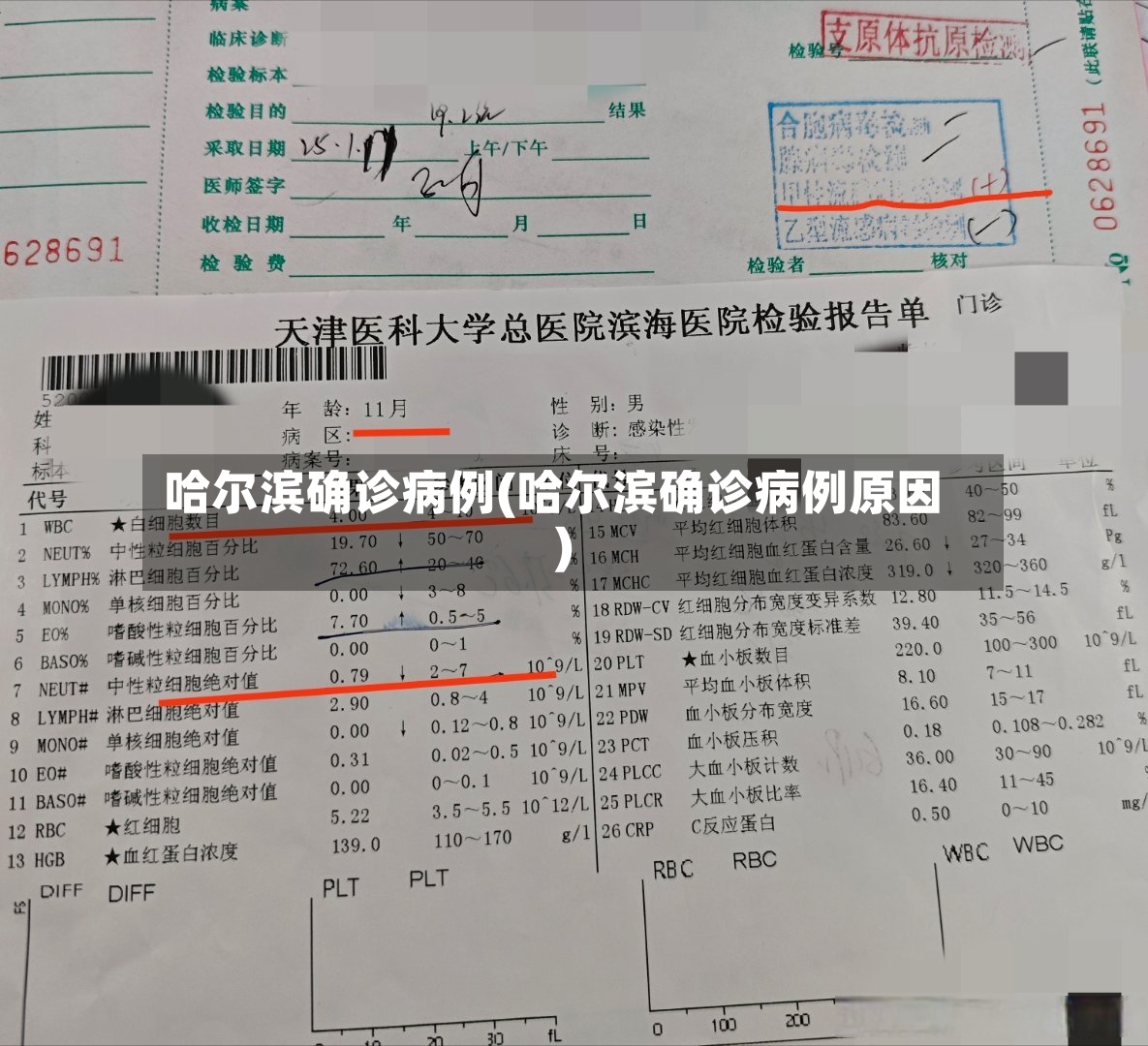 哈尔滨确诊病例(哈尔滨确诊病例原因)