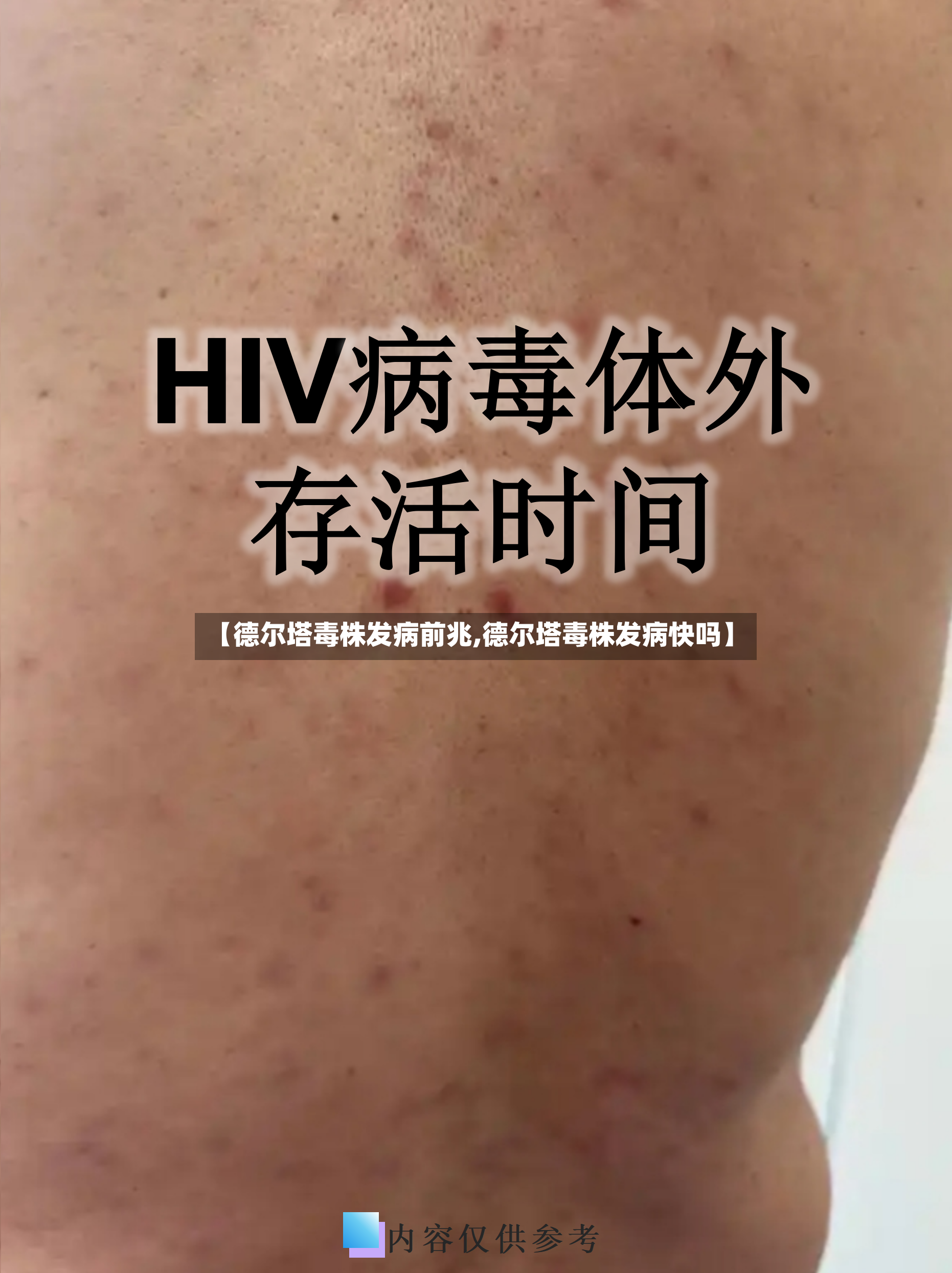 【德尔塔毒株发病前兆,德尔塔毒株发病快吗】-第2张图片