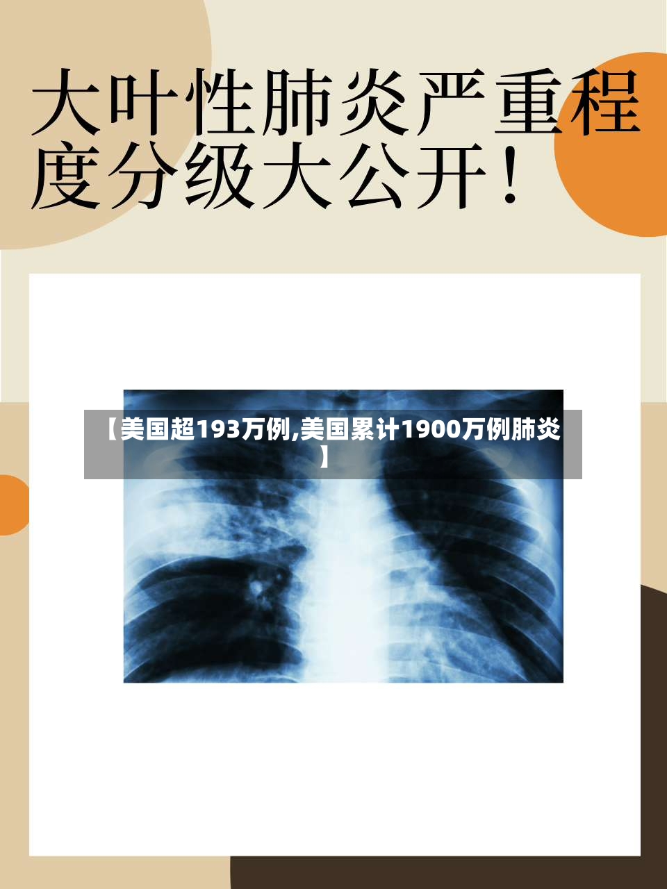 【美国超193万例,美国累计1900万例肺炎】-第2张图片