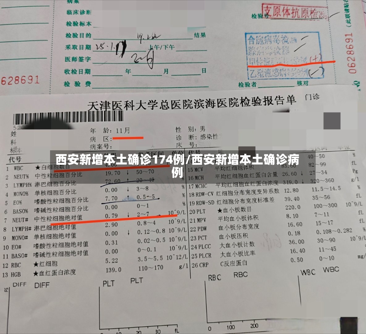 西安新增本土确诊174例/西安新增本土确诊病例-第2张图片