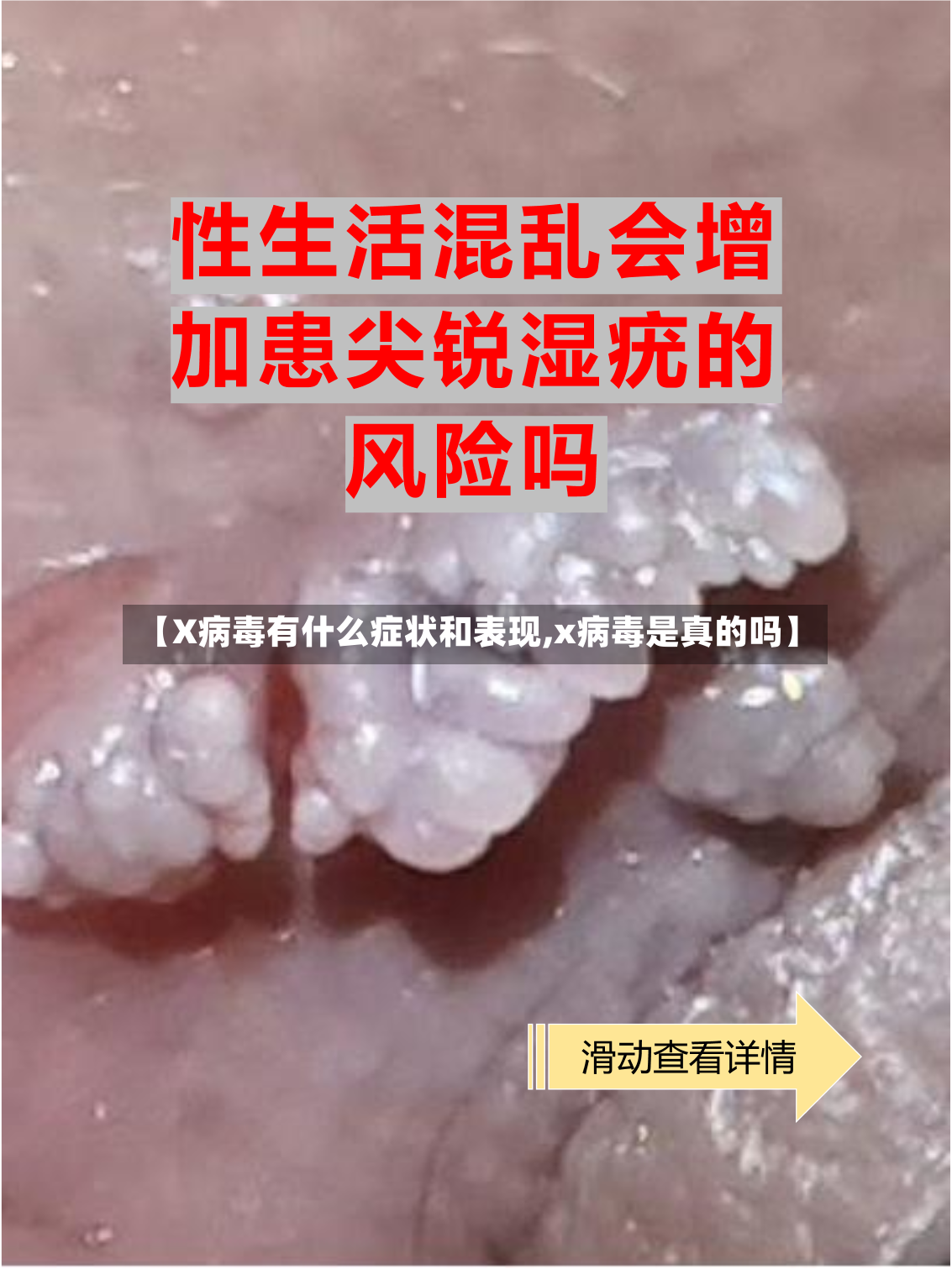 【X病毒有什么症状和表现,x病毒是真的吗】-第3张图片