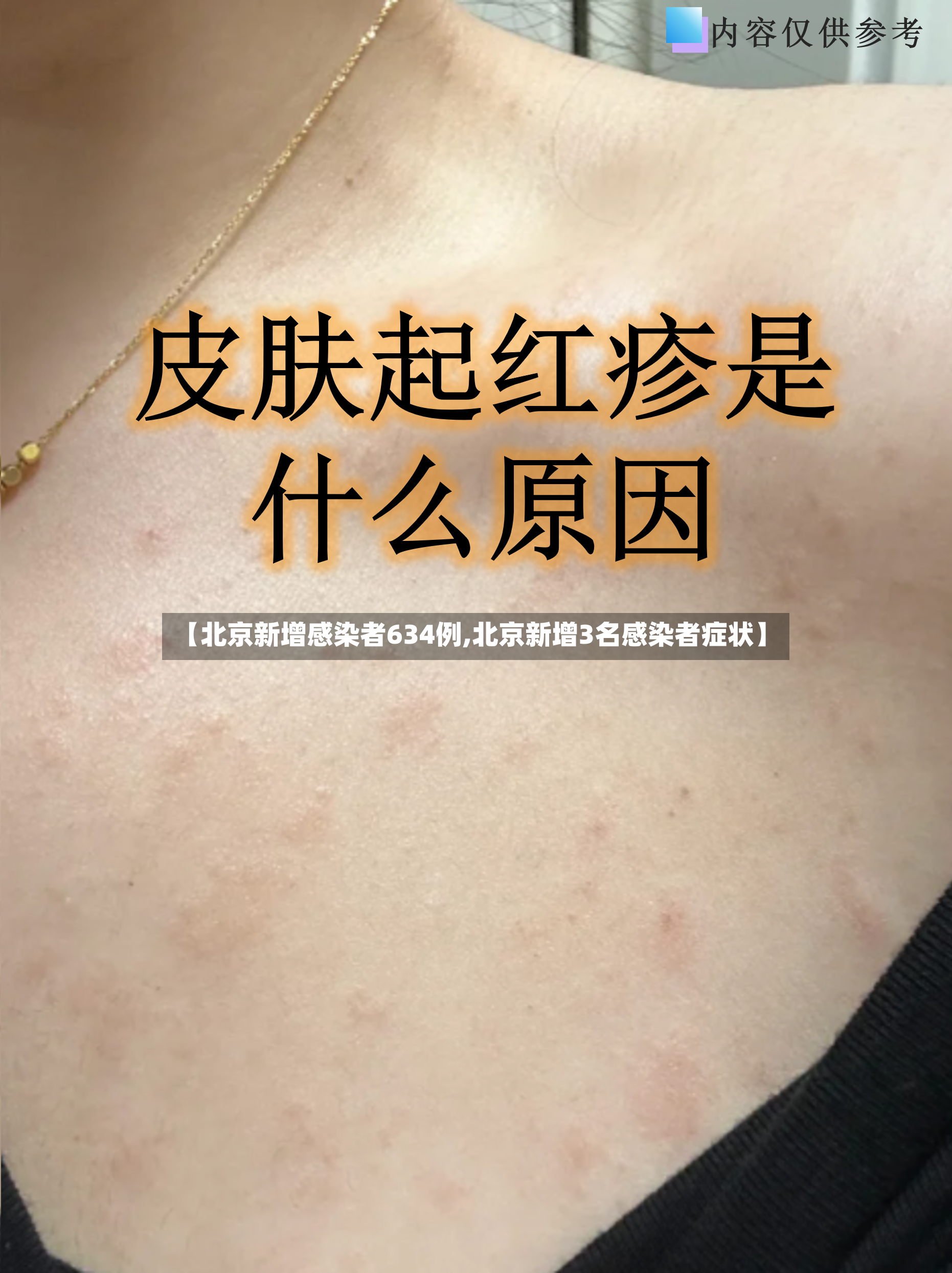 【北京新增感染者634例,北京新增3名感染者症状】-第2张图片