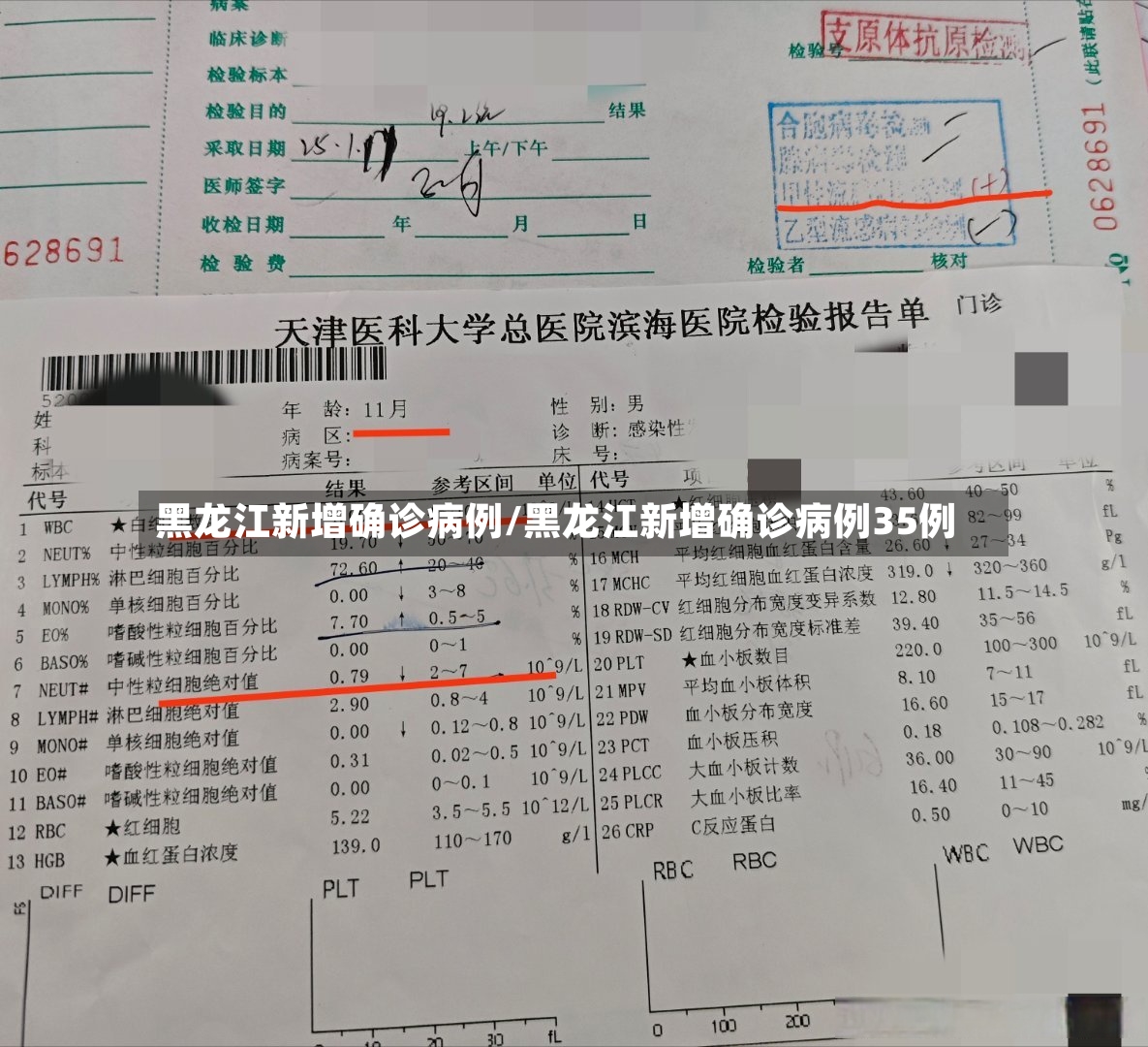 黑龙江新增确诊病例/黑龙江新增确诊病例35例