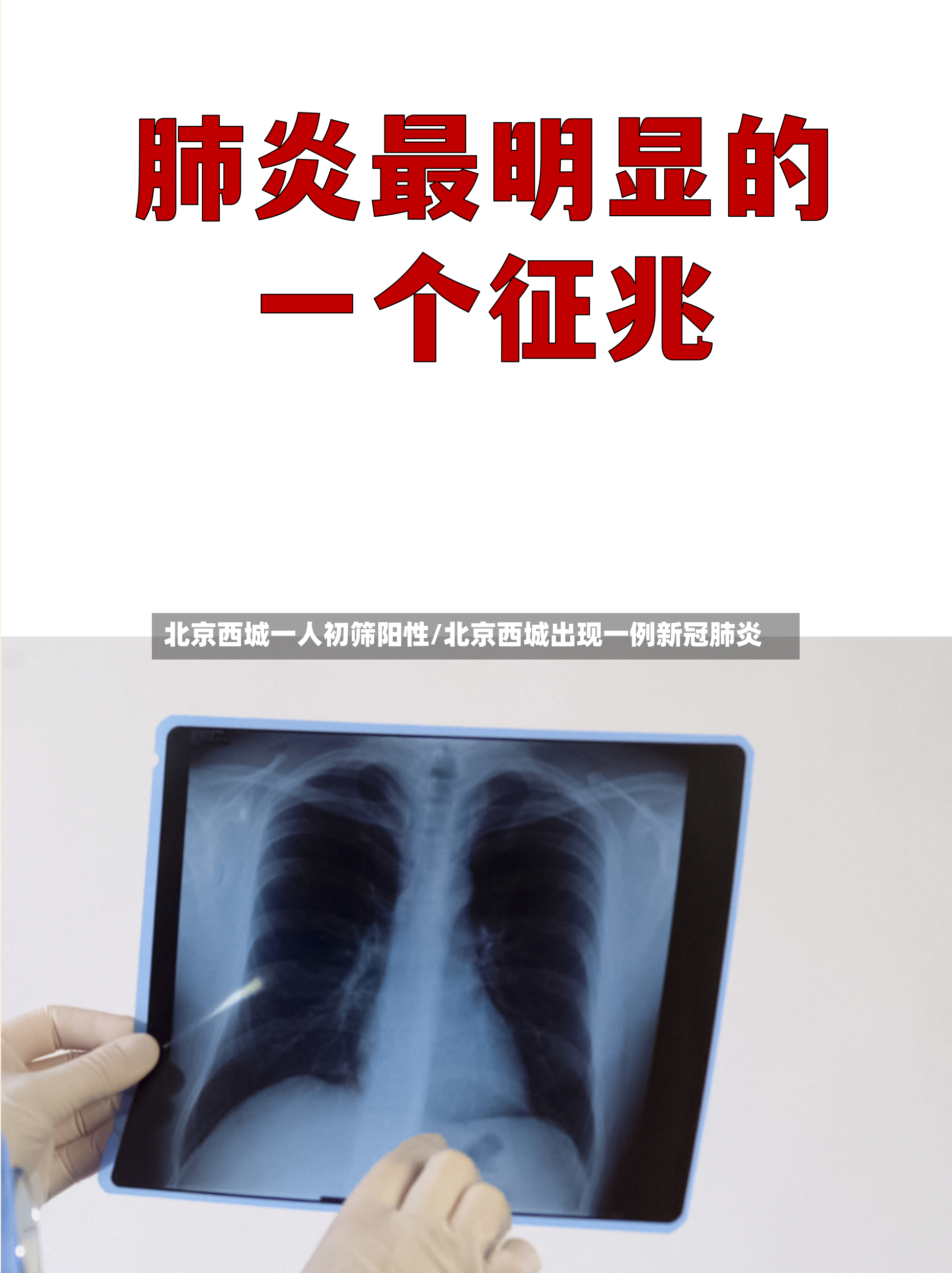 北京西城一人初筛阳性/北京西城出现一例新冠肺炎-第3张图片