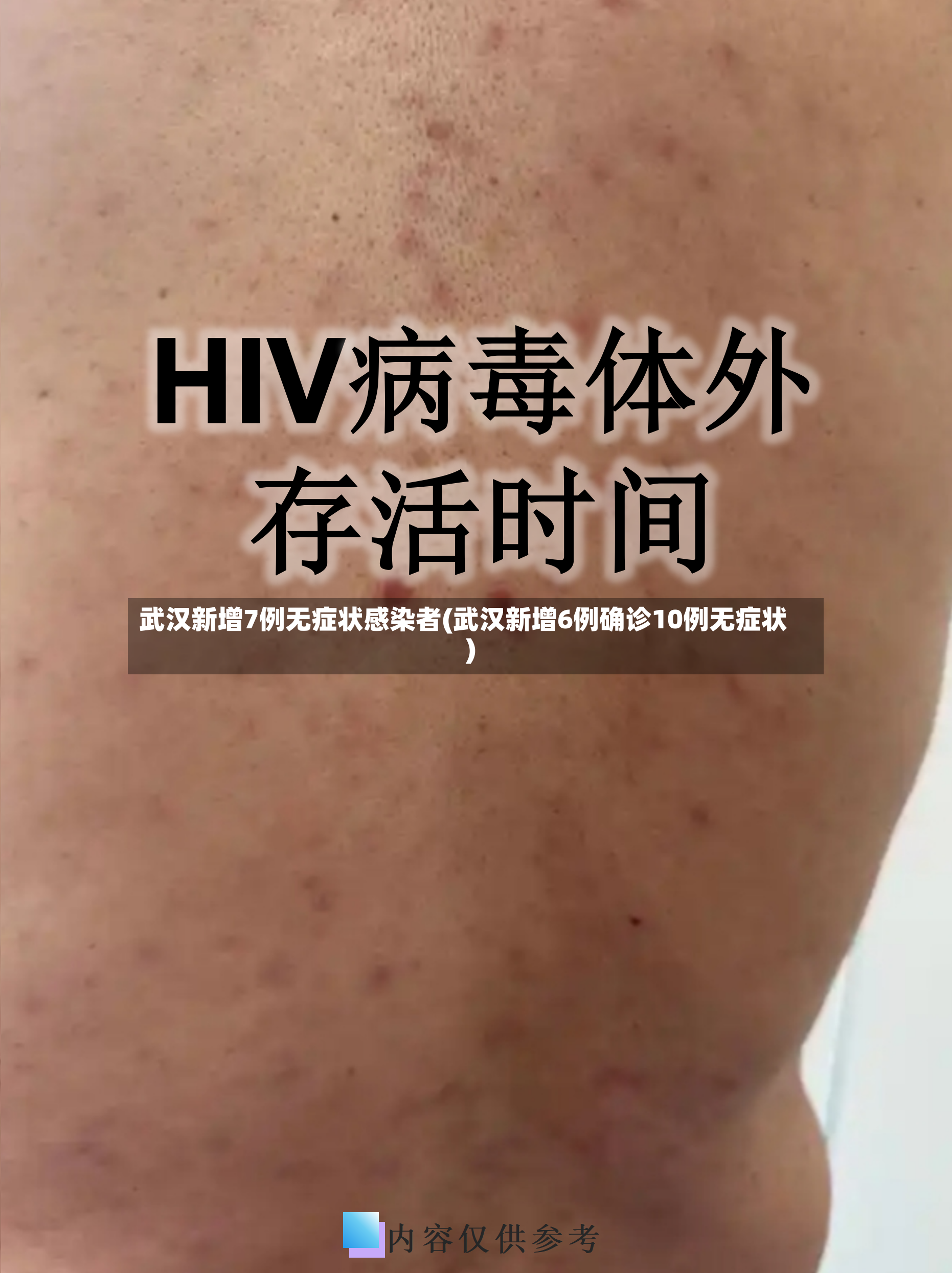武汉新增7例无症状感染者(武汉新增6例确诊10例无症状)-第2张图片