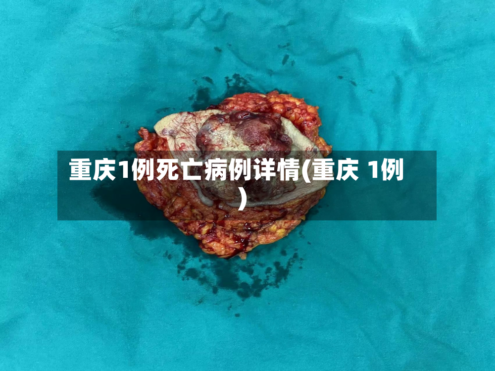 重庆1例死亡病例详情(重庆 1例)