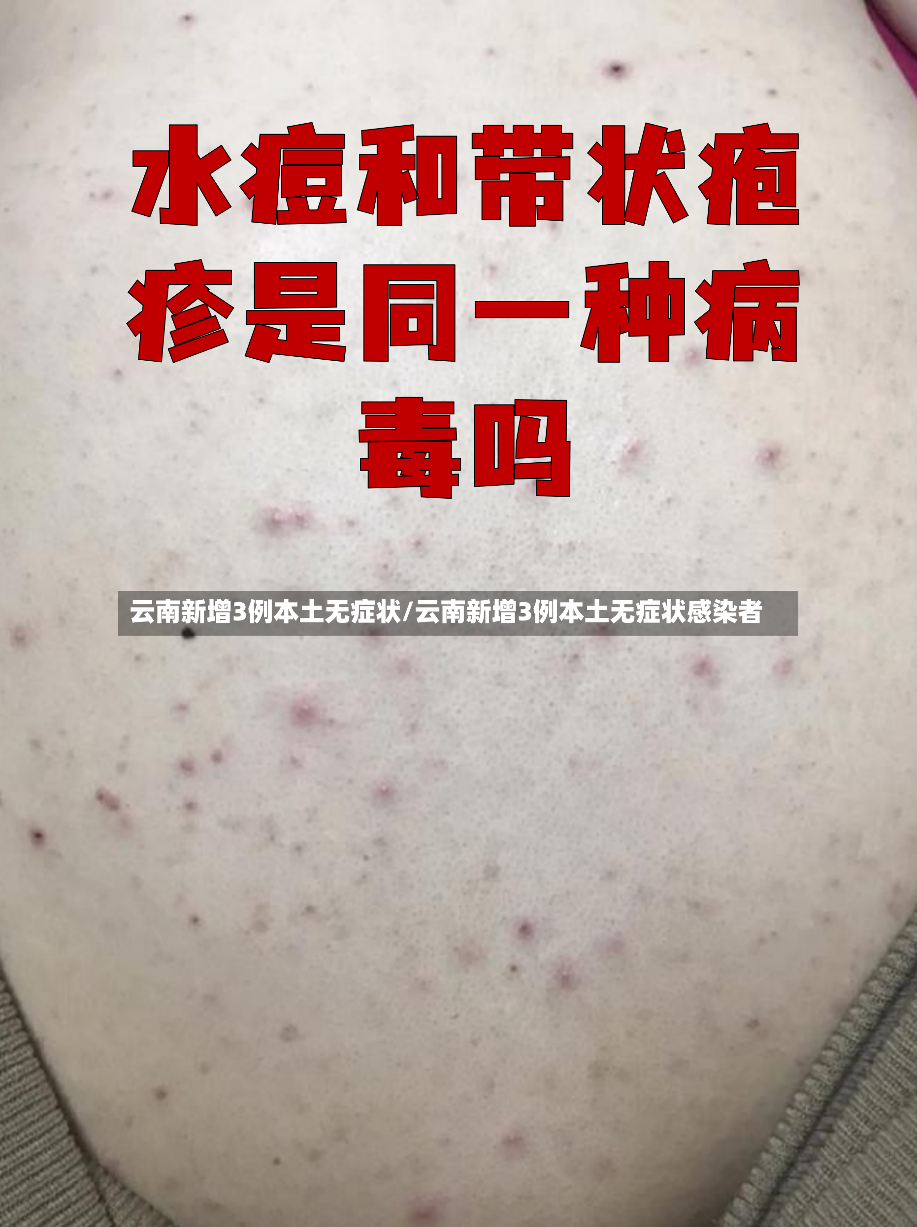 云南新增3例本土无症状/云南新增3例本土无症状感染者-第3张图片