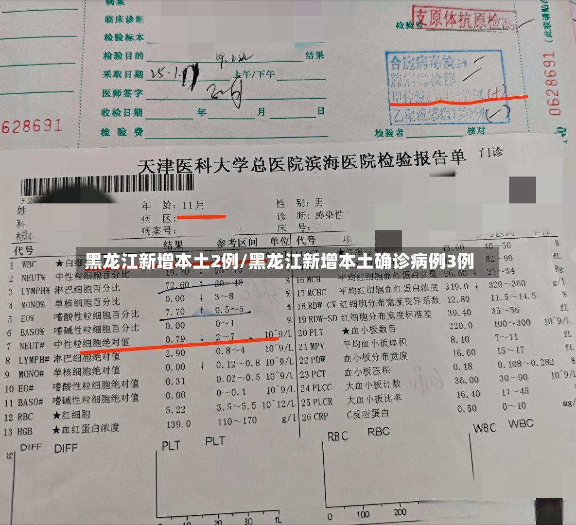 黑龙江新增本土2例/黑龙江新增本土确诊病例3例
