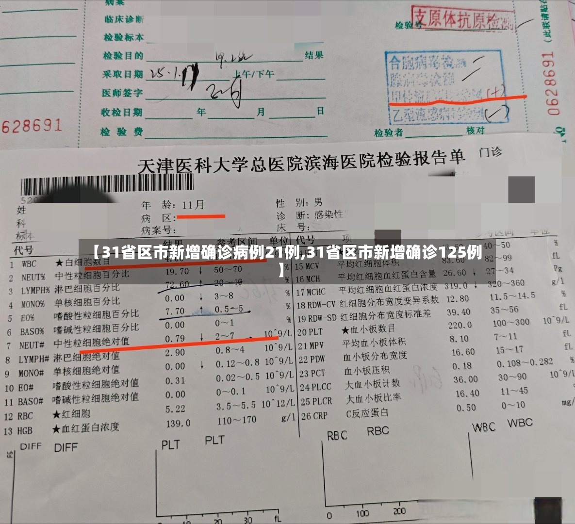 【31省区市新增确诊病例21例,31省区市新增确诊125例】-第2张图片