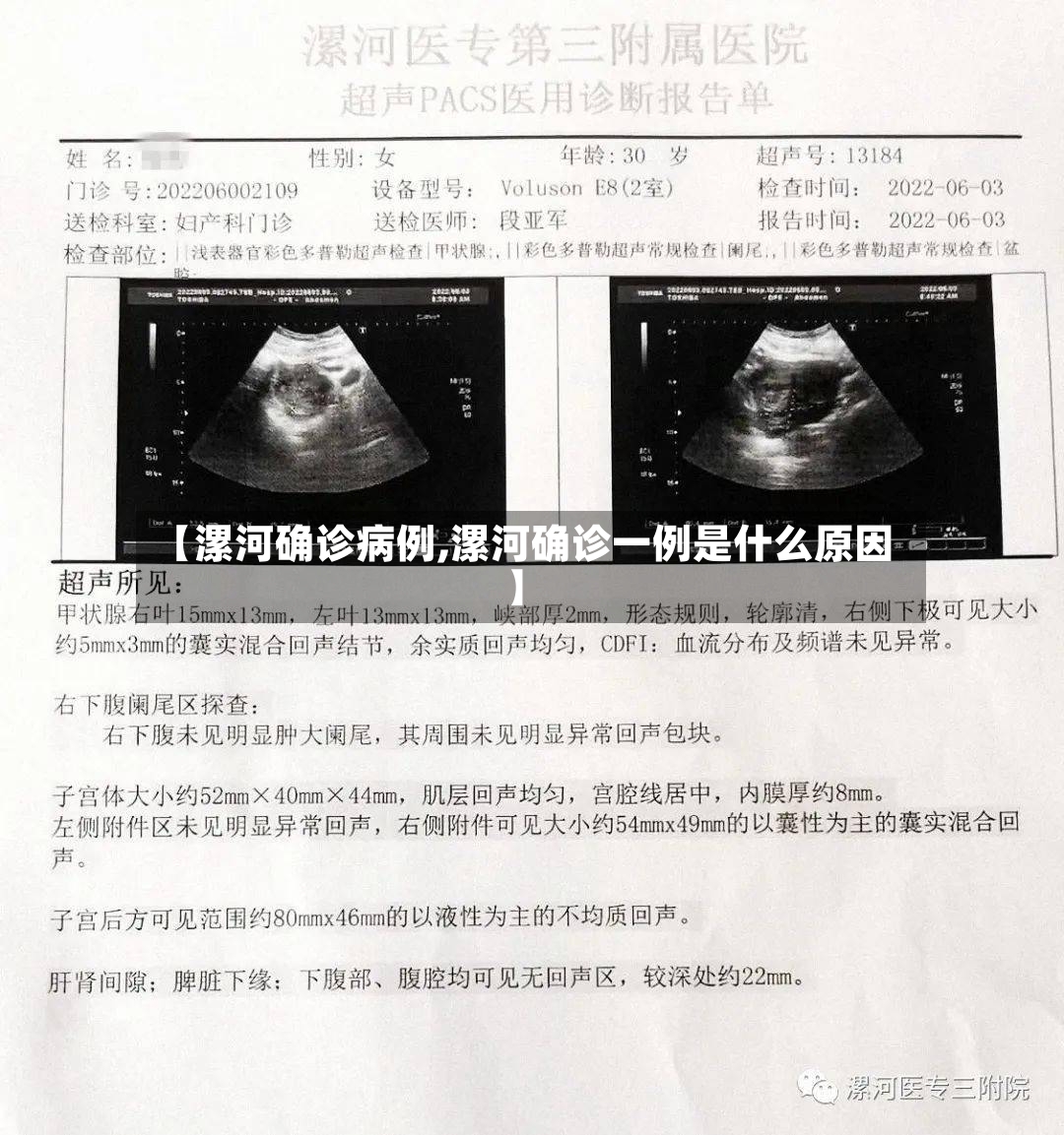 【漯河确诊病例,漯河确诊一例是什么原因】